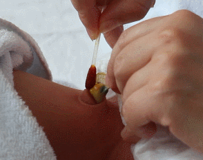 新生儿肚脐夹怎么打开新生儿宝宝的脐带什么时候脱落？肚脐的日常消毒怎么做？_https://www.jmylbn.com_新闻资讯_第13张