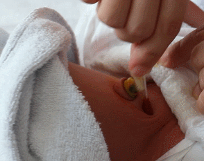 新生儿肚脐夹怎么打开新生儿宝宝的脐带什么时候脱落？肚脐的日常消毒怎么做？_https://www.jmylbn.com_新闻资讯_第15张