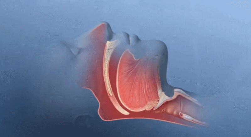 呼吸机呼吸压力怎么调家用无创呼吸机设置：IPAP压力如何调节？_https://www.jmylbn.com_新闻资讯_第2张