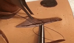 医疗缝线怎么做做手术时，伤口是这样缝的~_https://www.jmylbn.com_新闻资讯_第6张