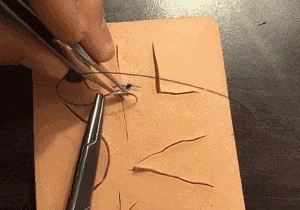 医疗缝线怎么做做手术时，伤口是这样缝的~_https://www.jmylbn.com_新闻资讯_第2张