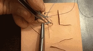 医疗缝线怎么做做手术时，伤口是这样缝的~_https://www.jmylbn.com_新闻资讯_第4张