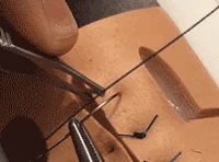 医疗缝线怎么做做手术时，伤口是这样缝的~_https://www.jmylbn.com_新闻资讯_第7张