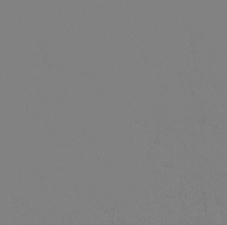 什么达医畅疗·第二期 ｜ 畅医达（Choydar）17小系统血流导向装置经桡治疗大脑中动脉动脉瘤_https://www.jmylbn.com_新闻资讯_第23张