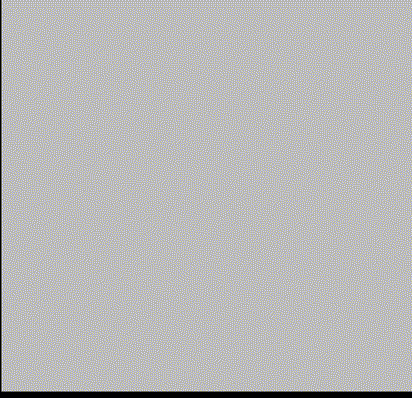 什么达医畅疗·第五期 ｜ 畅医达17小系统动脉瘤辅助支架治疗基底动脉尖不规则宽颈动脉瘤_https://www.jmylbn.com_新闻资讯_第23张