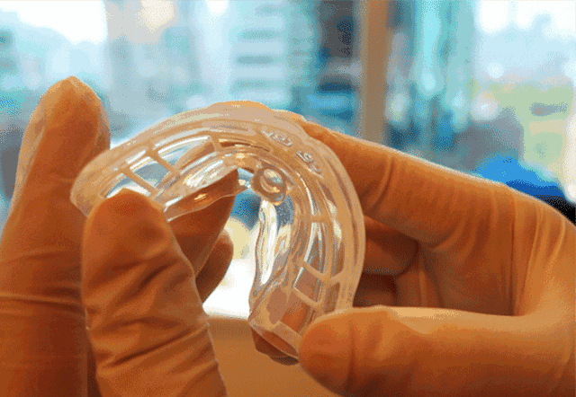 儿童早期矫治&mdash;&mdash;MRC肌功能正畸