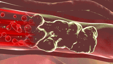 理疗热敷贴怎么贴这个东西是老寒腿克星！每天坚持能让腿脚年轻20岁！_https://www.jmylbn.com_新闻资讯_第17张