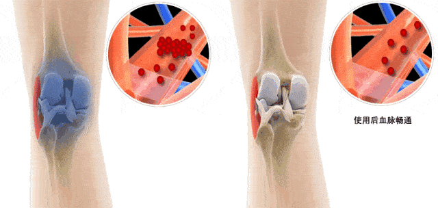 理疗热敷贴怎么贴这个东西是老寒腿克星！每天坚持能让腿脚年轻20岁！_https://www.jmylbn.com_新闻资讯_第27张