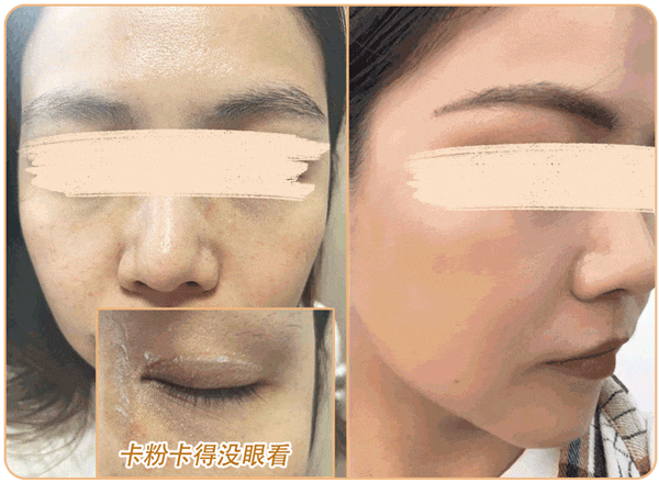 绽媄娅的产品怎么样比买包爽100倍！糕妈真香的“医美平替”，素颜照太惊艳了！年轻好几岁_https://www.jmylbn.com_新闻资讯_第54张