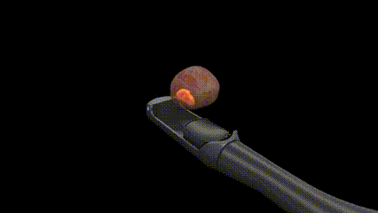 前列腺机器怎么治疗义诊及免费手术招募丨高能聚焦超声机器人即将落地我院，为前列腺增生及前列腺癌患者带来新选择_https://www.jmylbn.com_新闻资讯_第6张