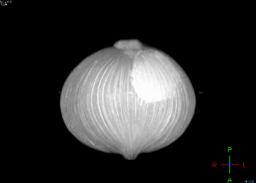 DR影像怎么重新上传【医疗服务提升】MR、CT、DR全新升级，精准影像助力精准诊疗！_https://www.jmylbn.com_新闻资讯_第8张