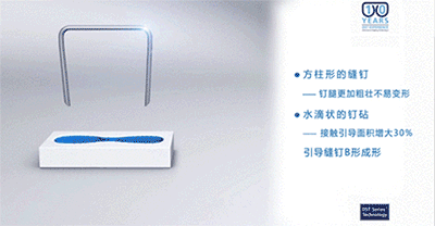 端端吻合器是什么【吻合器简史】谁说只有慢工能出细活？_https://www.jmylbn.com_新闻资讯_第10张