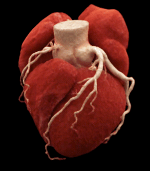 什么是联影ct真香预警？联影医疗双宽体双源CT大揭秘！TA竟然可以看到心脏的高清运动！_https://www.jmylbn.com_新闻资讯_第7张