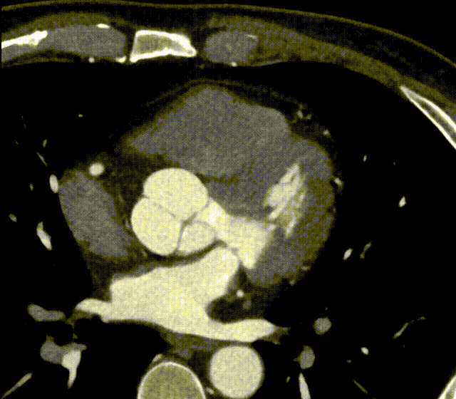 什么是联影ct真香预警？联影医疗双宽体双源CT大揭秘！TA竟然可以看到心脏的高清运动！_https://www.jmylbn.com_新闻资讯_第17张