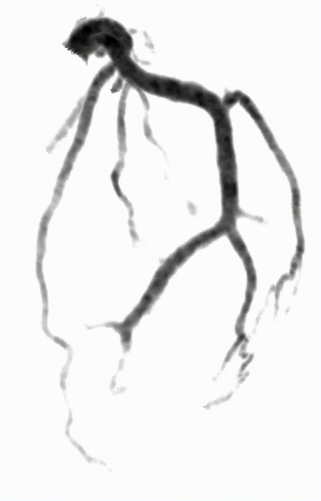 什么是联影ct真香预警？联影医疗双宽体双源CT大揭秘！TA竟然可以看到心脏的高清运动！_https://www.jmylbn.com_新闻资讯_第3张