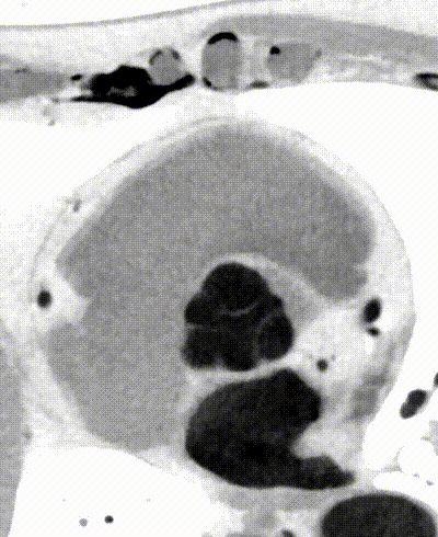 什么是联影ct真香预警？联影医疗双宽体双源CT大揭秘！TA竟然可以看到心脏的高清运动！_https://www.jmylbn.com_新闻资讯_第15张