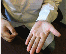 老年痴呆早期的四大信号灯，你亮了几个？教你一招远离老年痴呆~