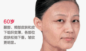 射频刀都有什么微针、射频、超声刀你都了解多少？-上海聚慕医疗器械有限公司