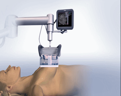 什么是超声容积探头乳腺超声诊断再上台阶——自动乳腺容积超声成像ABVS_https://www.jmylbn.com_新闻资讯_第4张