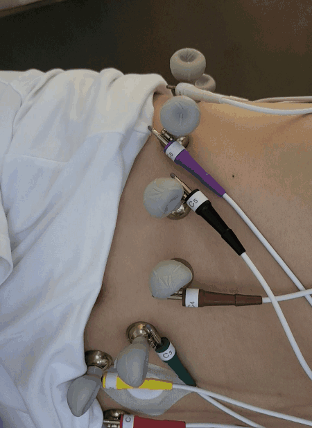 日本心电图怎么用营口市中西医结合医院最新引进日本光电次世代高端心电图机ECG-2450_https://www.jmylbn.com_新闻资讯_第9张