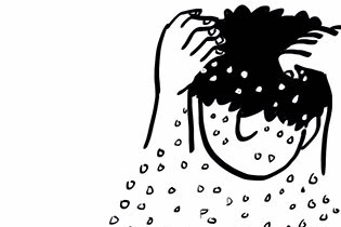 令人烦恼的头皮脂溢性皮炎，这几点要先弄清楚……【内含福利】