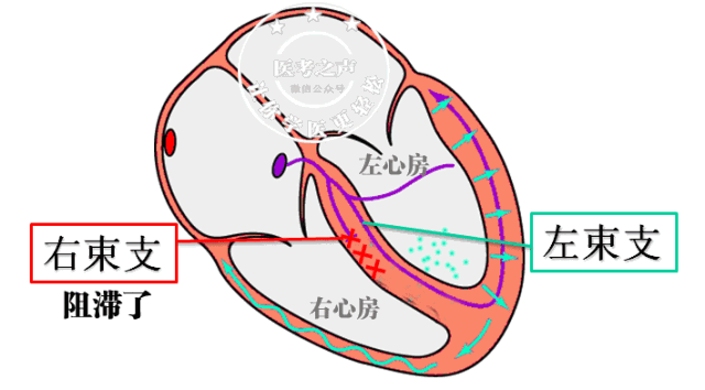 学习心电图，这是我见过最完美的文章！