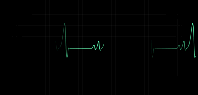 床旁监护仪怎么看ICU坚强卫士---床旁监护仪_https://www.jmylbn.com_新闻资讯_第18张