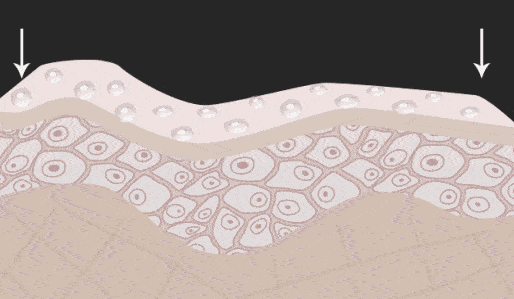 冬季更要呵护要娇嫩的头皮