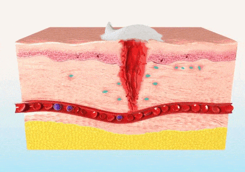 促愈凝胶怎么排出「DR.ROTUS卡波姆痔疮凝胶」消肿止痛，止血止痒，促进愈合_https://www.jmylbn.com_新闻资讯_第46张