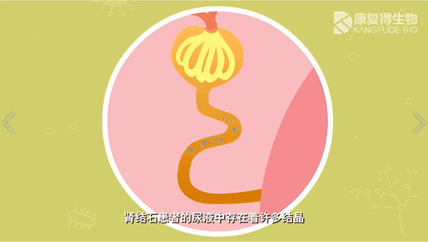 肾结石防治科普视频-最全的都在这里了!(珍藏版) 肾结石防治科普视频-最全的都在这里了!(珍藏版)