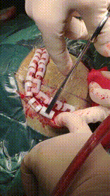 手术头皮夹怎么放神外有趣的小物件---头皮夹_https://www.jmylbn.com_新闻资讯_第7张