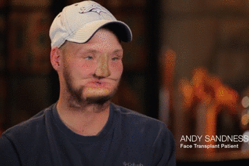 手术|手术时，医生切开你的身体后都做了什么？胆小者勿进