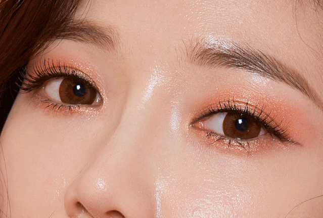 上睑凹陷矫正术 重睑术 这样的女孩真的很加分 上海首尔丽格医疗美容医院订阅号 微信公众号文章阅读 Wemp