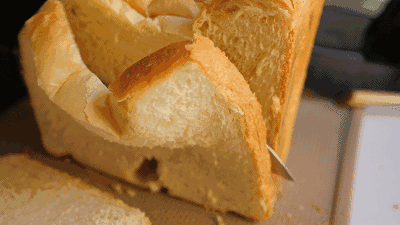 x射线为什么叫dr【医学影像】DR、CT、核磁共振，骨科检查选哪个？_https://www.jmylbn.com_新闻资讯_第9张