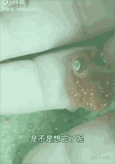 一个“网红”，决定向死而生
