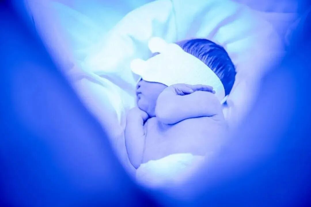 光疗时为什么黑眼罩蓝光治疗时，为何要遮住眼睛和屁屁？_https://www.jmylbn.com_新闻资讯_第2张