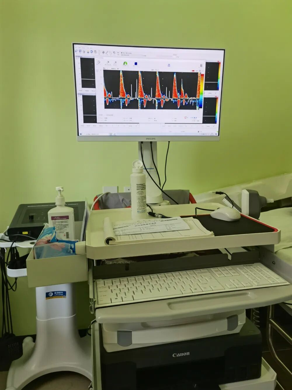 为什么糖尿病不能震动广大糖友福音来啦！内分泌科开展新项目了—ABI和数字化震动感觉阈值检查_https://www.jmylbn.com_新闻资讯_第12张