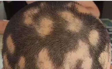 姿势鬼剃头究竟是怎么回事？如何抓住这个鬼？答案都在这