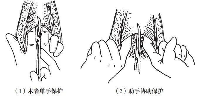 组织钳又叫什么小技巧 ｜｜ 如何把手术切口切得整齐又美观_https://www.jmylbn.com_新闻资讯_第8张