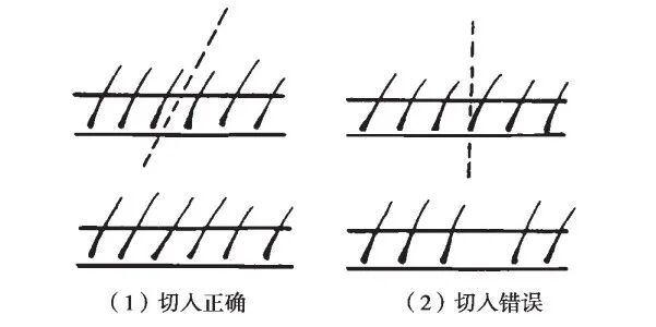 组织钳又叫什么小技巧 ｜｜ 如何把手术切口切得整齐又美观_https://www.jmylbn.com_新闻资讯_第4张