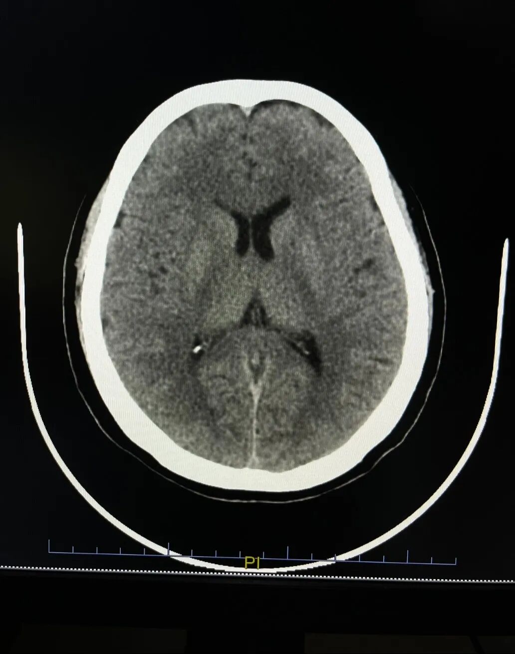 共享医疗设备有哪些【医共体建设】医疗设备从“独有”到“共享”，推进共享医疗新发展_https://www.jmylbn.com_新闻资讯_第5张