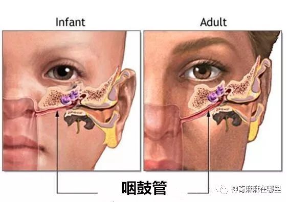 感冒後寶寶得這種病極易被忽視！爸媽一定要知道！ 親子 第6張