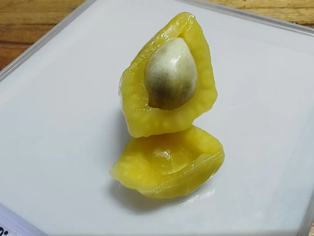 瘦脸针多少钱一针