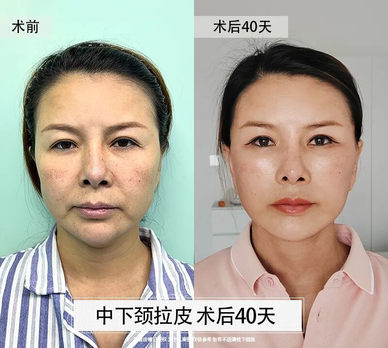 κ������Ƥ����