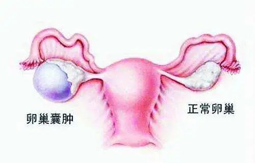 發生這些情況，早點要孩子比較好 親子 第5張