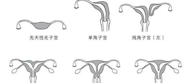 子宫发育不良会引起哪些症状?