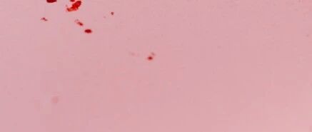 月经量过多如何改善？