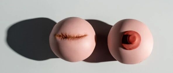 乳腺纤维瘤手术可以做到多微创？