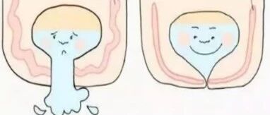 近三成孕妇产后漏尿，这究竟是什么原因？