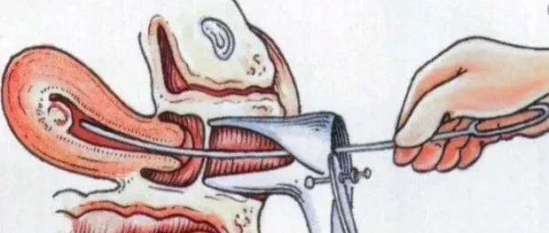 这些伤害子宫的行为，劝你趁早停止！